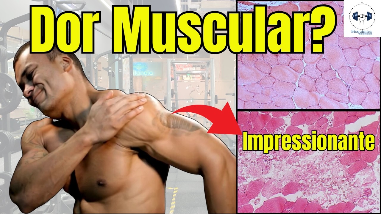 DOR MUSCULAR TARDIA | Causa | Como Evitar | Mitos Revelados!
