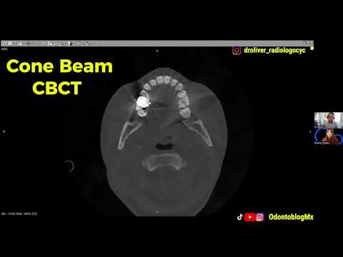 Cone Beam