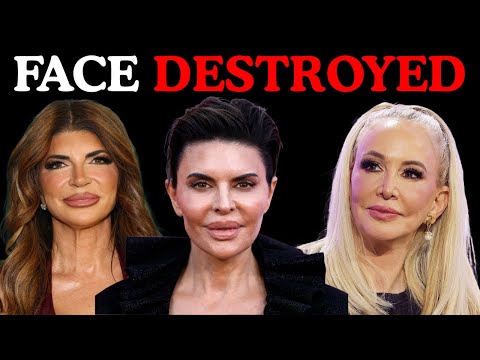 11 Real Housewives Housewives Who Kept Getting Surgery — And Lost Their Original Look