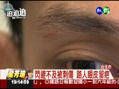 賣傘像在舞劍! 戳傷眼皮留疤