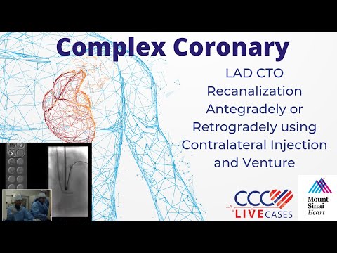 LAD CTO Recanalization Antegradely or Retrogradely w/ Contralateral Inject. & Venture May 2010 Video