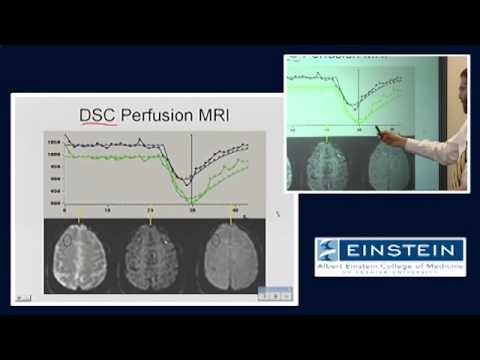 Introducing MRI: Perfusion Imaging (53 of 56)