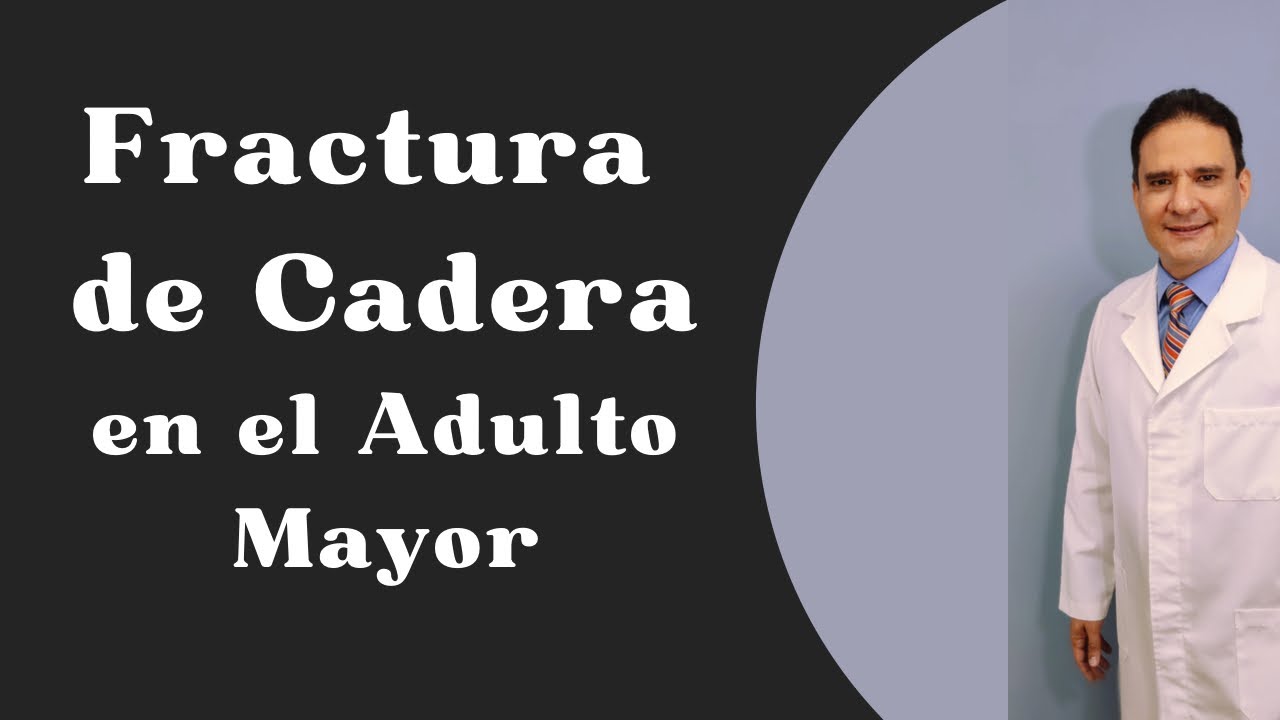 FRACTURA DE CADERA DEL ADULTO MAYOR