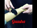Guasha Treatment Kearney Chiropractor