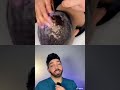 Doctor Reacts to Dandruff Hack | Doctorly #shorts