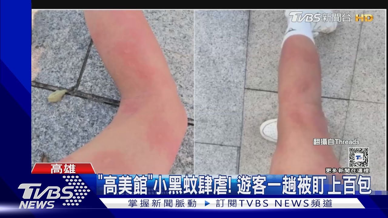 高美館一遊 民眾被叮上百包!雨後小黑蚊肆虐 館方說話了