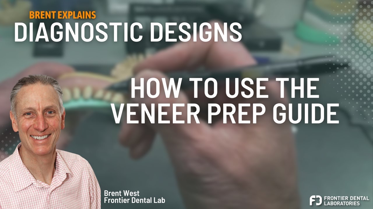Diagnostic Designs: How to use Prep Guides to ensure proper reduction