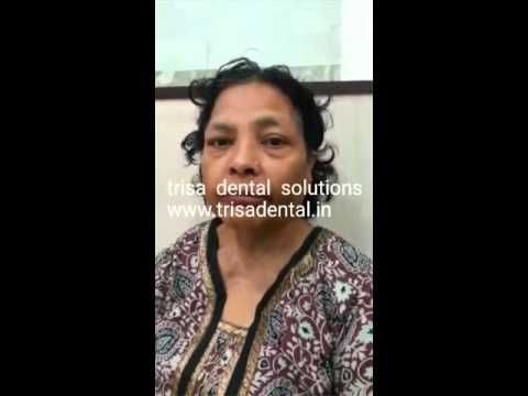 Trisa Dental Solutions - Metal Braces