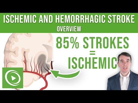 Overview of Ischemic and Hemorrhagic Stroke | Lecturio