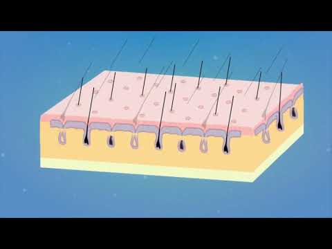 Laser Hair Removal Cycle