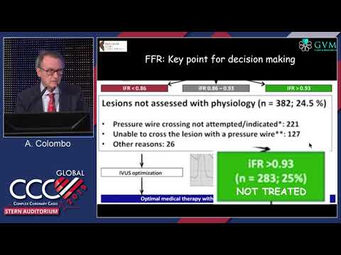 FFR/Imaging-Guided PCI will be Equal to CABG - Dr. Colombo