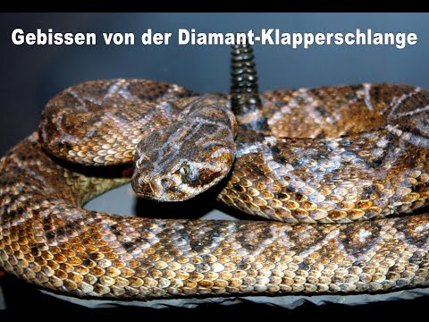 Erfahrungsbericht: Gebissen von der Diamant-Klapperschlange | Kurzdoku Schlangenbiss
