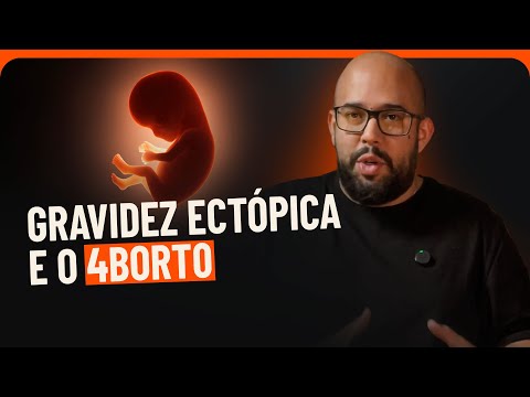 A IGREJA CATÓLICA permite 4BORT0 em caso de risco à MÃE? | PAC #113