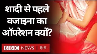Vagina ऑपरेशन क्यों करा रही हैं Unmarried Girls, क्या इसका ताल्लुक Virginity से है? video