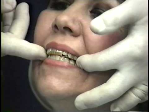 Basic Articulator System Instruction Part 1