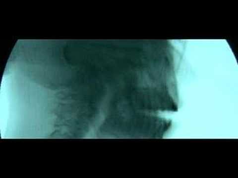 Straatligkinders 'Avontuur van 'n Hartbreek' (OFFICIAL MUSIC VIDEO)