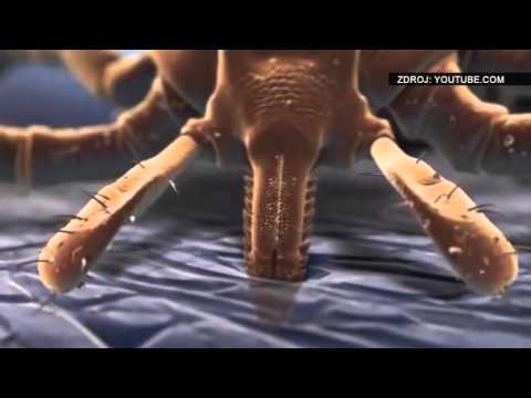 download lagu mp3 mp4 Klíšťová Encefalitida, download lagu Klíšťová Encefalitida gratis, unduh video klip Download Klíšťová Encefalitida Mp3 dan Mp4 Viral Gratis
