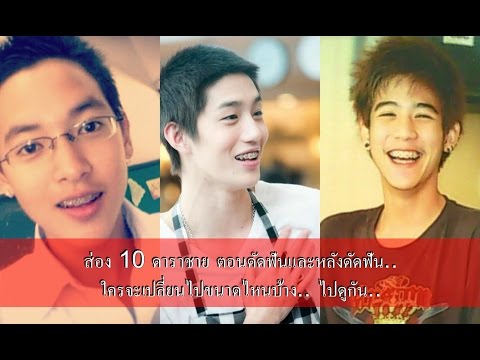เหตุผลสำหรับความอ่อนแอ การสำรวจความอ่อนแอชาย