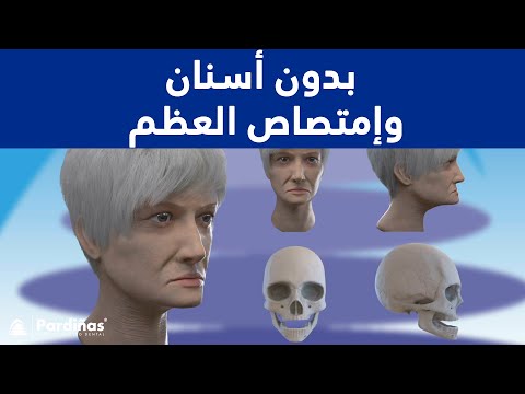 © بدون أسنان وإمتصاص العظم