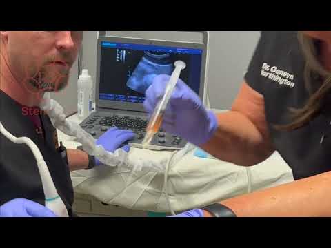 Ultrasound Guided SI Joint Injections R3 Stem Cell (844) GET-STEM