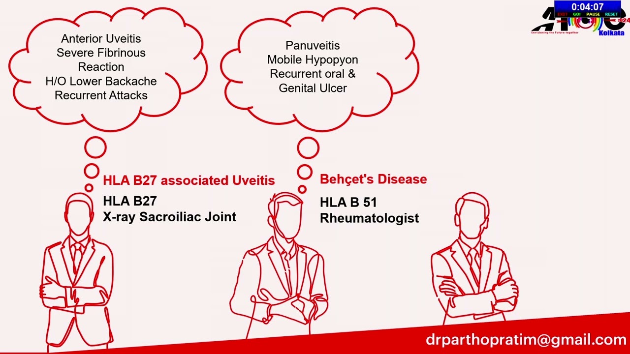 The red flag signs in anterior uveitis