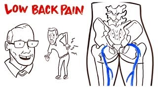 Low Back Pain