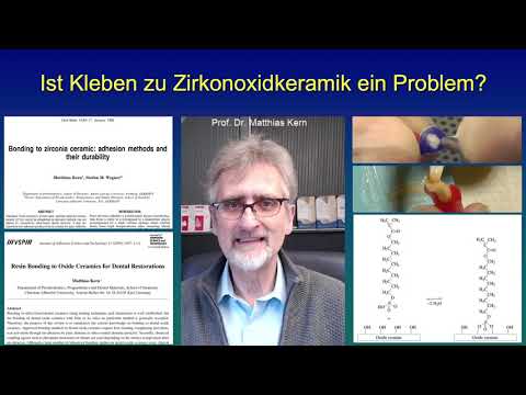 Ist Kleben zu Zirkonoxidkeramik ein Problem?