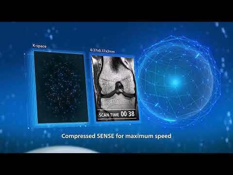 Ultimate precision at maximum speed with Philips SmartSpeed Precise