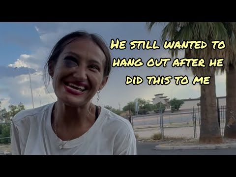 Why is this young pretty woman walking around with a black eye 