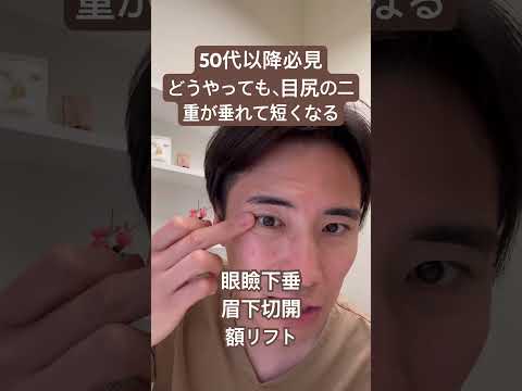 医学科 なぜ、目尻の二重が垂れるのか