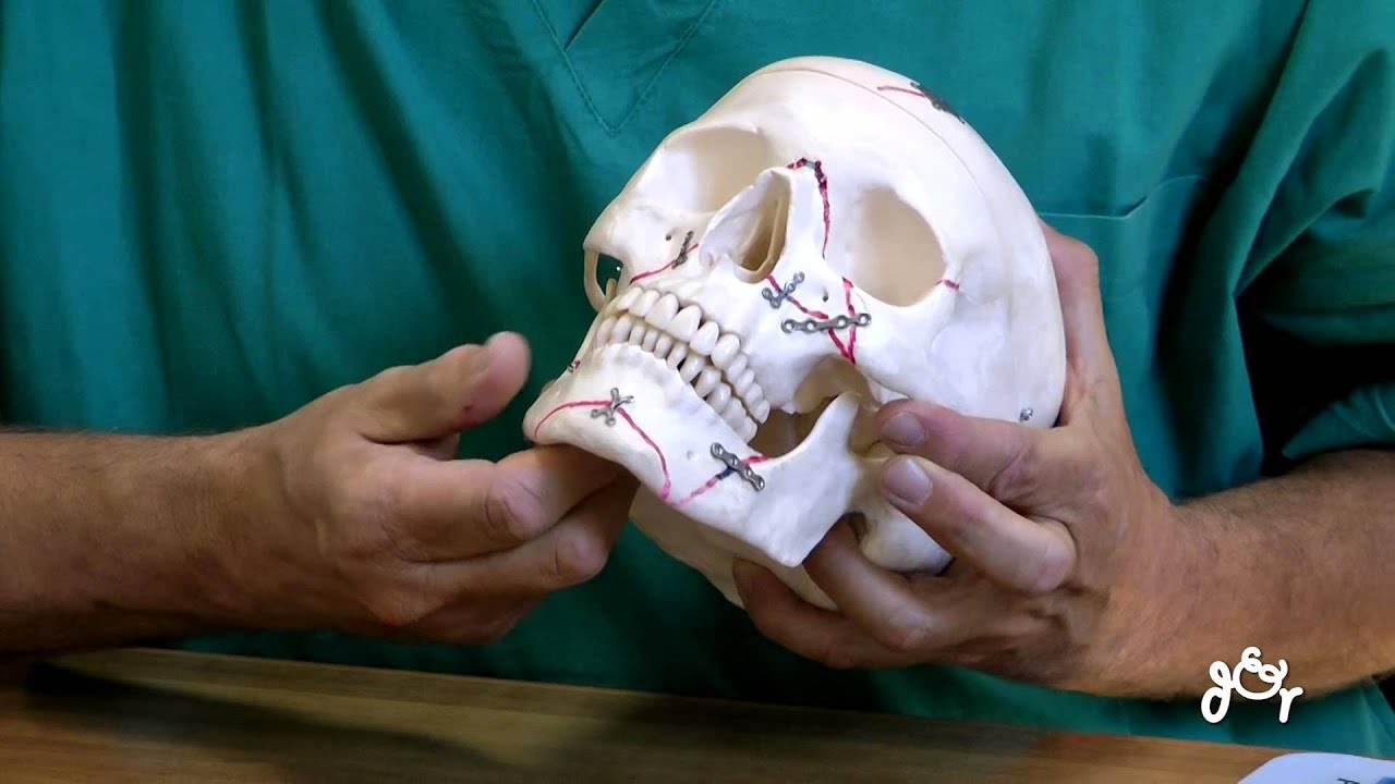 Anatomia, Funzioni e Chirurgia del Distretto Maxillo Facciale