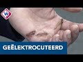 Niuwa krijgt stroomschok op balkon en verbrandt zijn hand - OMROEP WEST