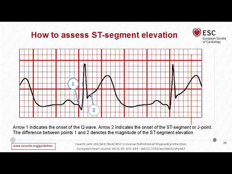 Acute coronary syndrome :what non cardiologist need to know: slides show