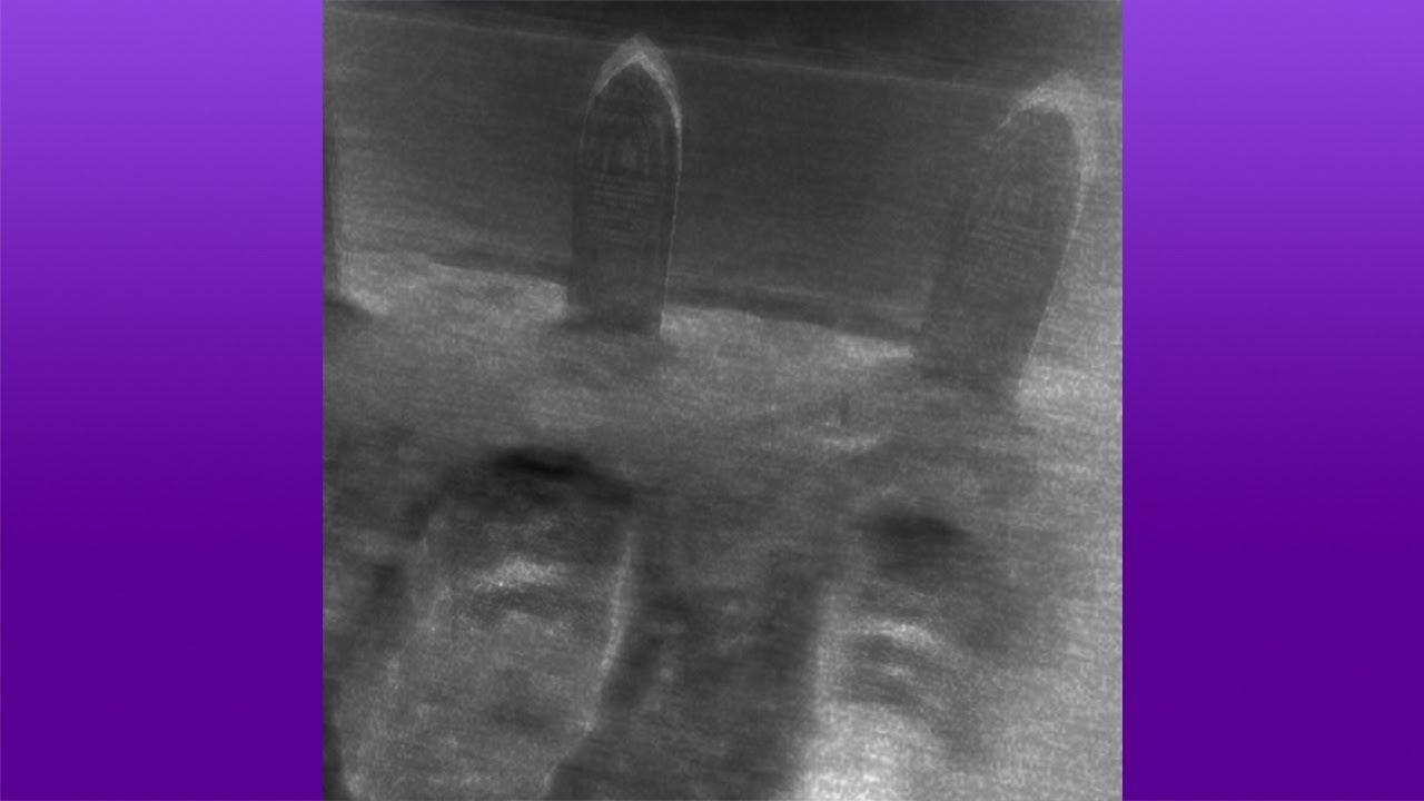 [EP] Mental Project - CheetoZ