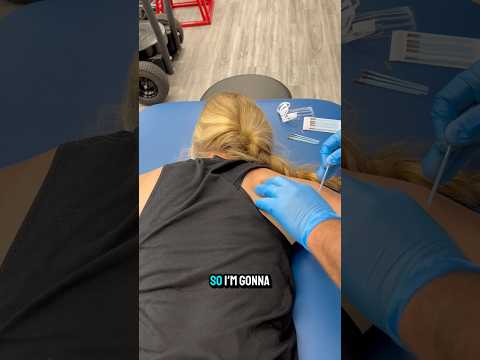 Dry needling is used to treat a variety of issues like neck, shoulder, & back pain  #dryneedling