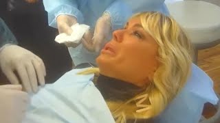 Matilde Brandi in lacrime, ha i denti neri per un errore del dentista: guarda