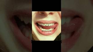 Download lagu #18freewill #tattoos #hairtransformation #percings😍 #fypシ゚viral mp3 Download lagu #18freewill #tattoos #hairtransformation #percings😍 #fypシ゚viral mp3