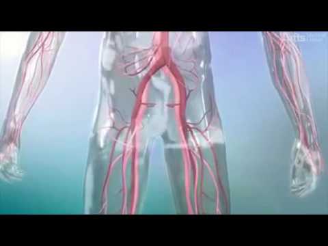 Wie oft Prostata-Massage Matrix von Prostata-Adenom