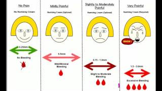 How to use derma roller