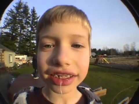 How To: Pull Out A Tooth With A Rocket