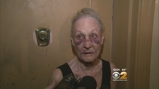 Robbery Victim Speaks Out
