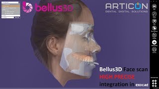 Интеграция скана лица(Bellus3D) в программу Exocad. Наиболее точный протокол.