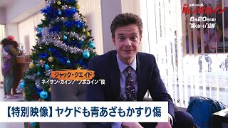 【特別映像】ヤケドも青あざもかすり傷(字幕版)