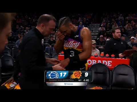 Dillon Brooks BREAKS Hand in DEVASTATING Injury