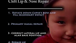 Four Components of Lip Nose Repair