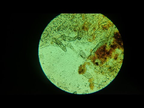 Koi fry Disaster 😭 more flukes and poorly koi