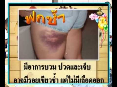 เพิ่มขึ้นครีมสมาชิกฟรี ทั้งไม่ต้องใช้ยาเพื่อเพิ่มความแข็งแรง