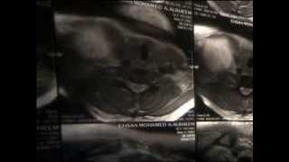 Surgical Radiology - 18 cases + Head & Neck images