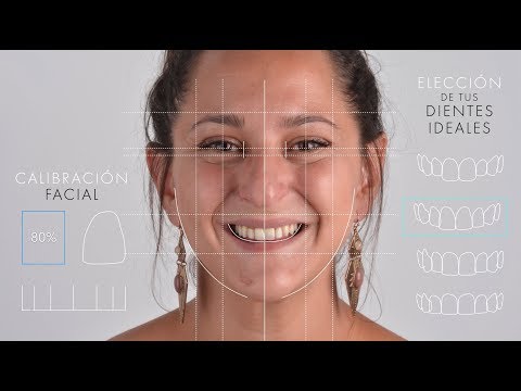 Pepa Rus : Estética Dental