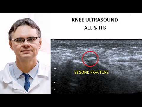 IT Band & Anterolateral Ligament Ultrasound | ITB Syndrome and ALL Anatomy – Knee MSK Ultrasound